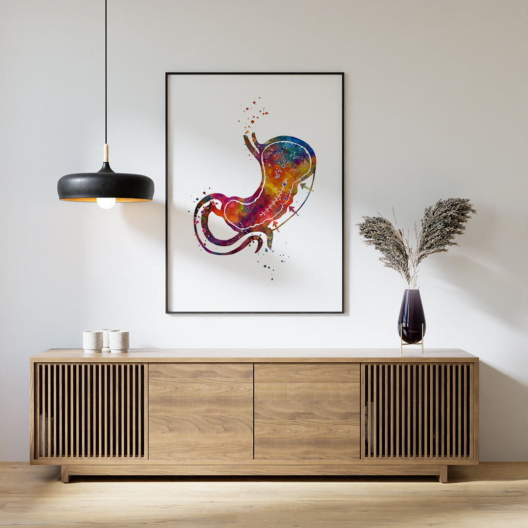 Endoscopic Sleeve Gastroplasty Colorful Watercolor Print
