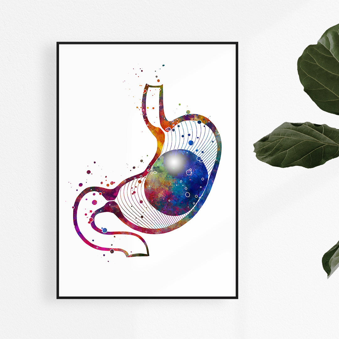 Intragastric Balloon for Weight Loss Watercolor Art Print