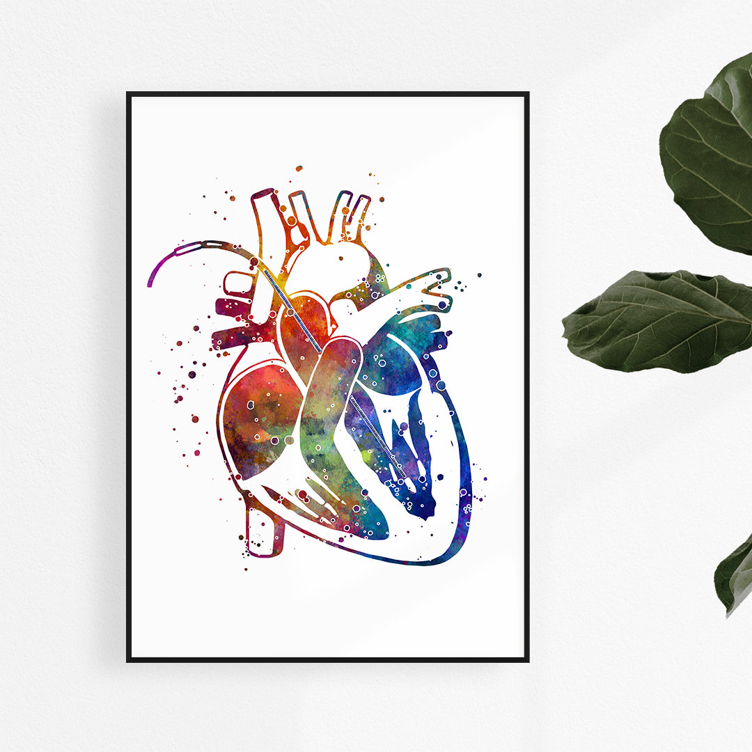 Watercolor Print Impella Heart Pump