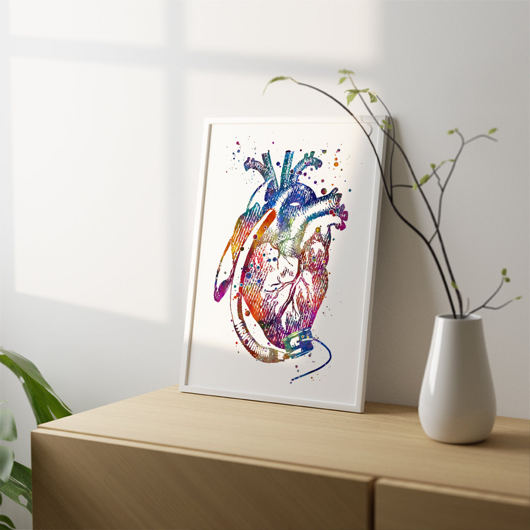 Heart with LVAD Watercolor Art Print