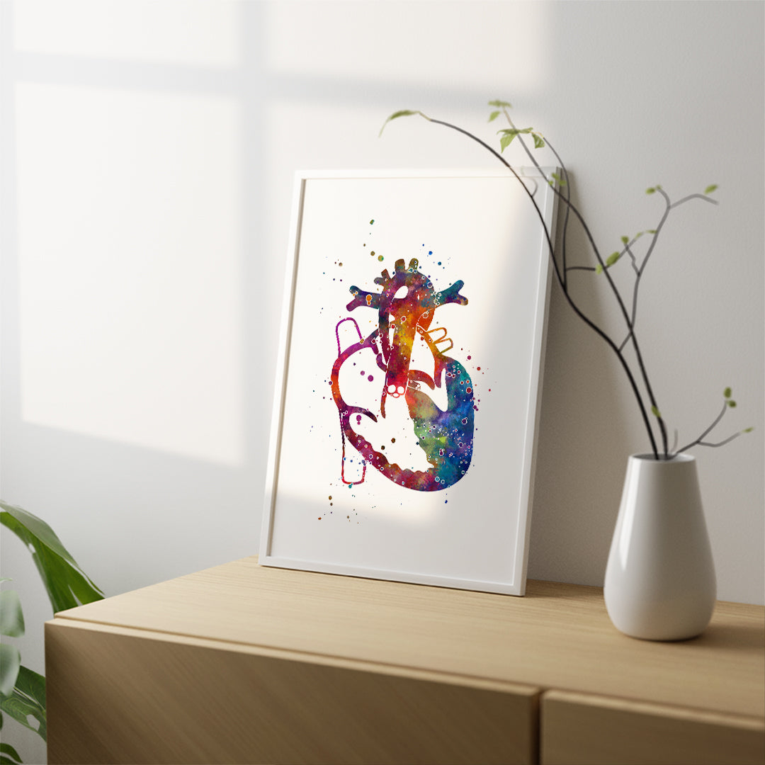 Hypoplastic Left Heart Syndrome Print
