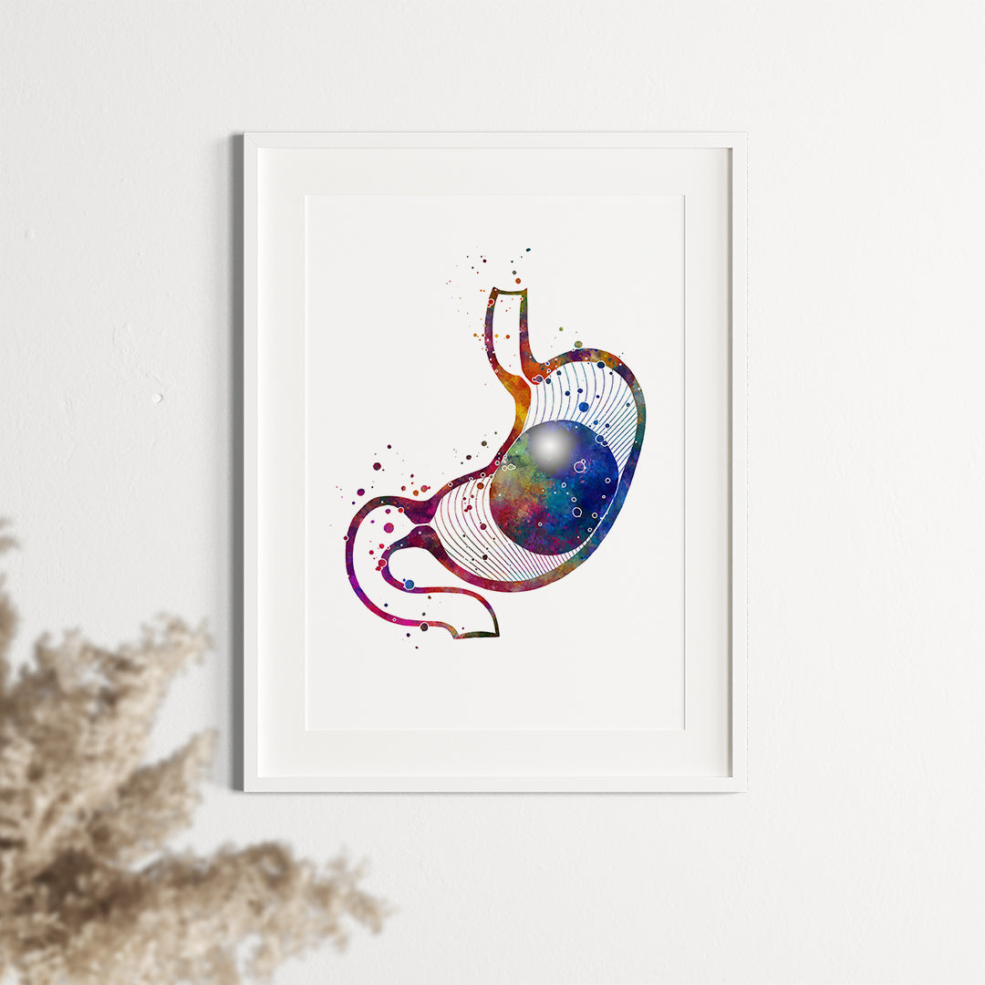 Intragastric Balloon for Weight Loss Watercolor Art Print