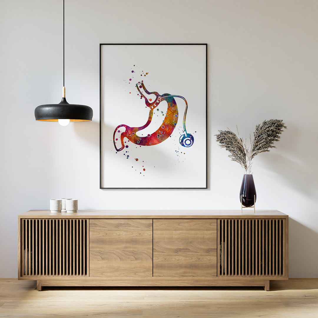 Gastric Band Bariatric Surgery Art Watercolor Print