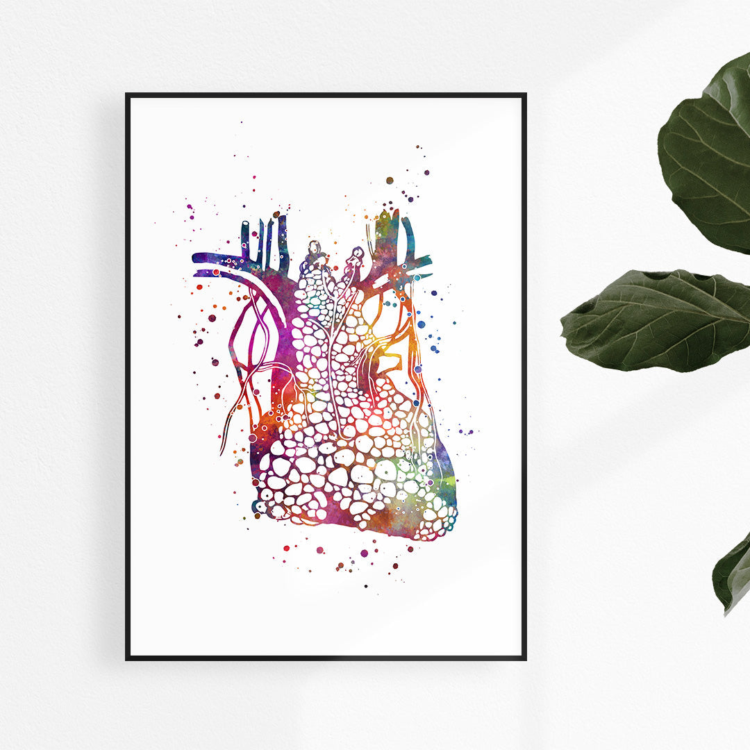 Heart Thymoma Medical Art Print