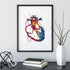Hypoplastic Left Heart Syndrome Print