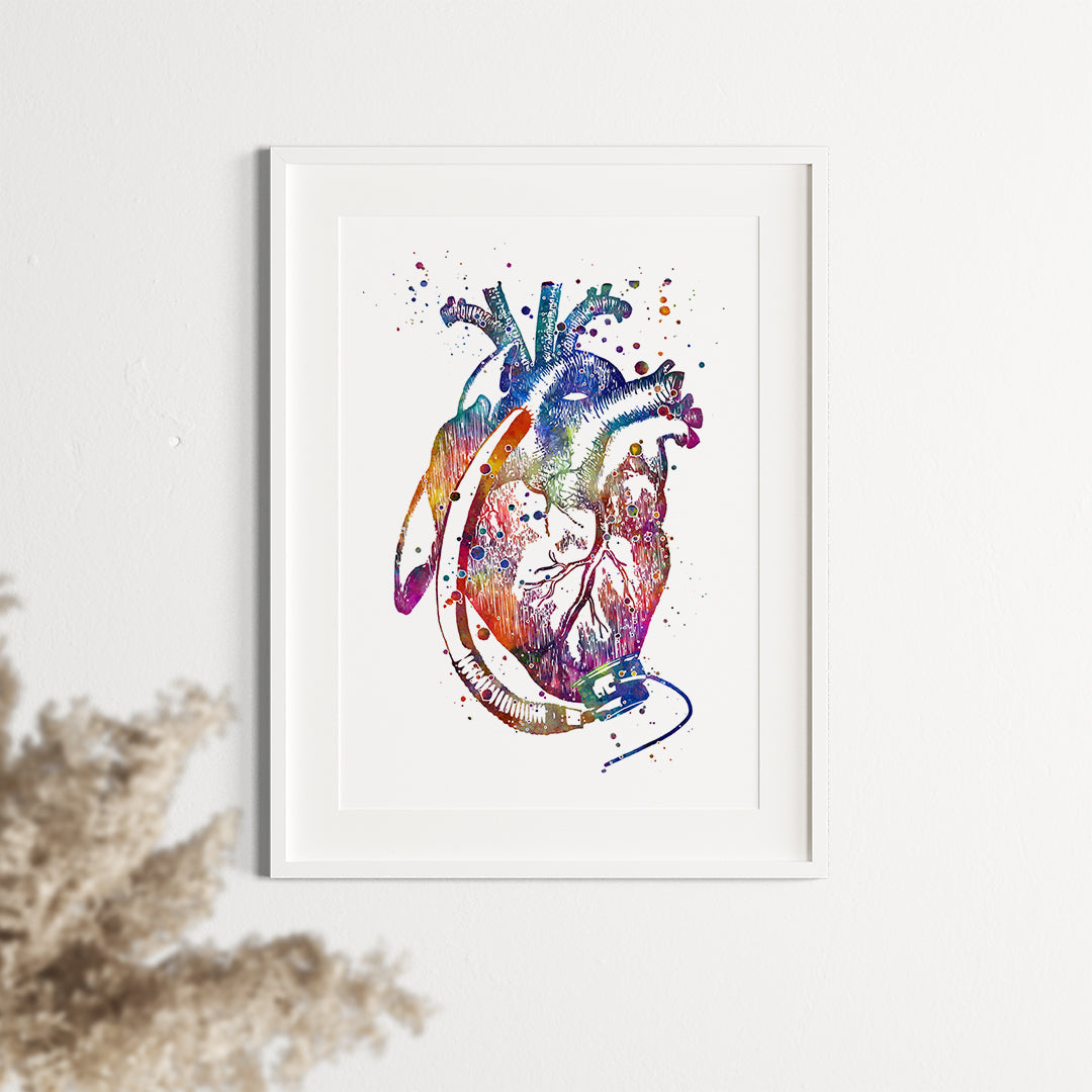 Heart with LVAD Watercolor Art Print