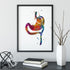 Roux En Y Gastric Bypass Anatomy Art Print