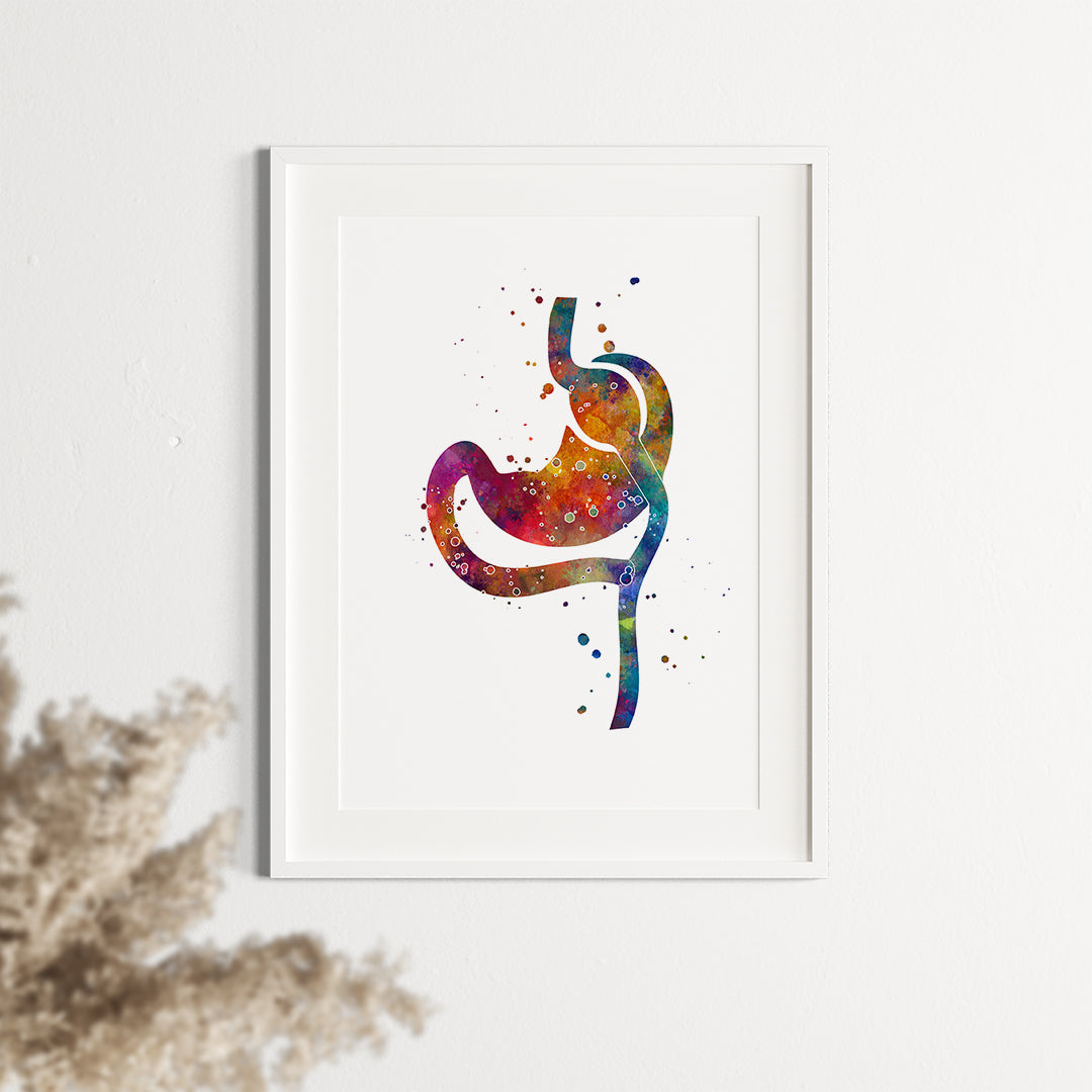 Roux En Y Gastric Bypass Anatomy Art Print